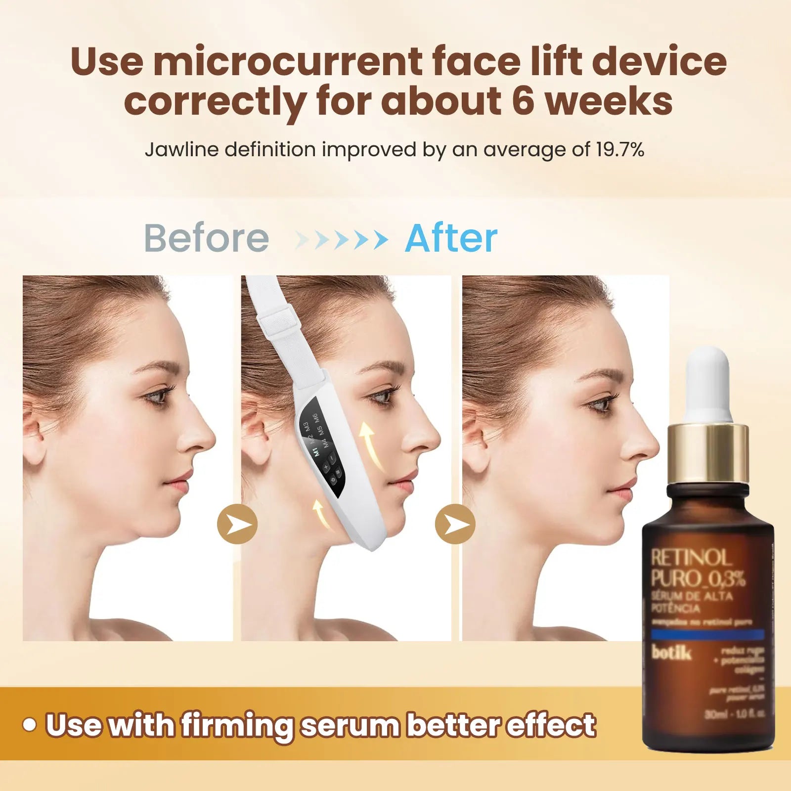 Electric V Face Lifting